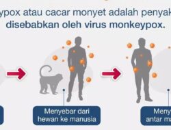 Waspada Cacar Monyet